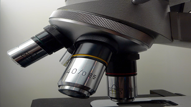 Dieta Dukan ¿peligrosa para los riñones? Dieta Dukan ¿peligrosa para los riñones?