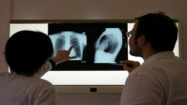 Dieta Dukan ¿peligrosa para los riñones? Dieta Dukan ¿peligrosa para los riñones?